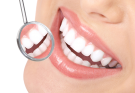 Look And Feel More Comfortable With Cosmetic Teeth Implants